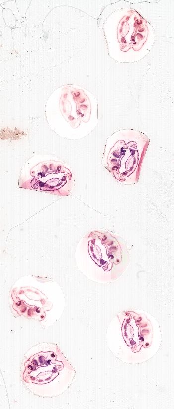 Media type: image; Special Collections 3992   shows specimen_part histological serial section;
